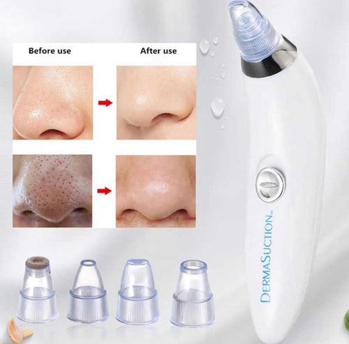 Blackhead Removal Machine Derma Suction 4 in 1 Black Head Remover Machine